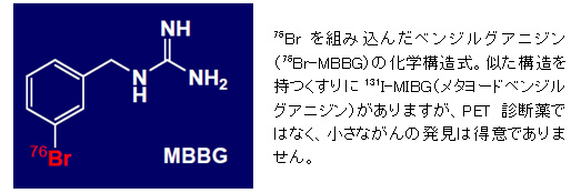 76Brgݍ񂾃xWOAjWi76Br-MBBGj̉w\B