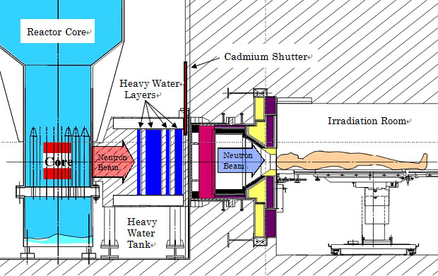 Development of a medical irradiation facility